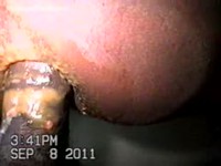 Amateur girl shitting on a cock during anal sex
